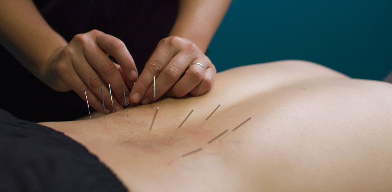 Everything You Should Know About Ultrasound Guided Dry Needling
