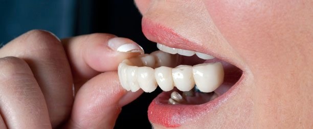 What Is the Difference Between Dental Crowns and Tooth Bridges?