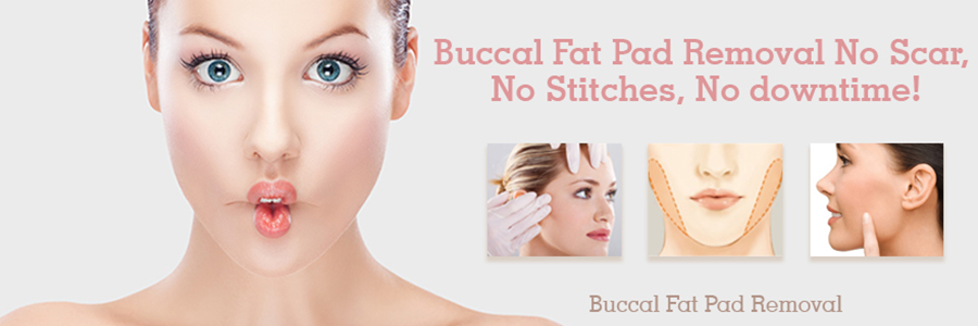 Buccal-Fat-Pad-Removal-vadodara