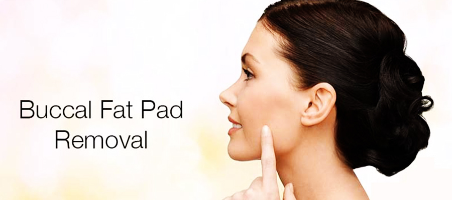 Buccal Fat Pad Removal
