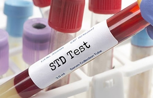 Everything You Need to Know About STD Testing