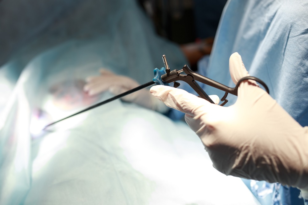 Uses and Advantages of Laparoscopic Instruments