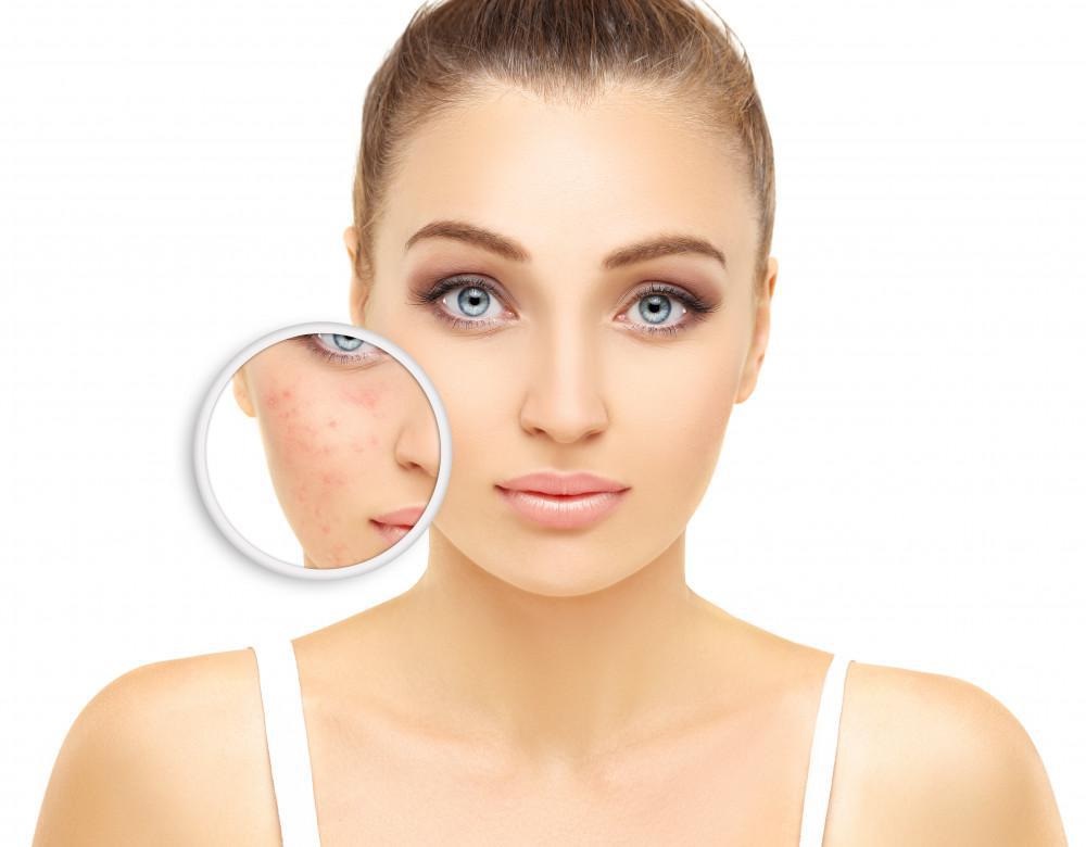 What You Need to Know about Choosing the Right Facial Skin Rejuvenation Treatment