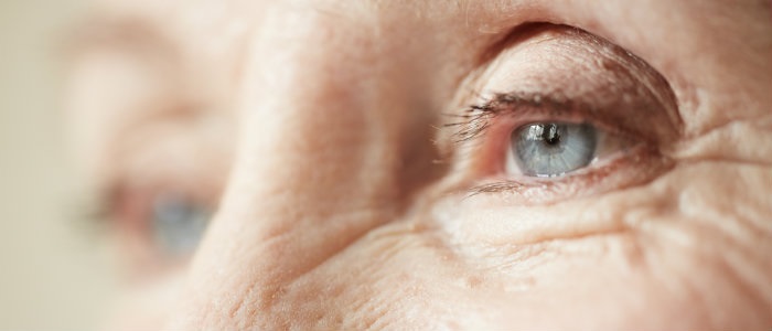 Catch These Early Signs of Cataract Issues Before It’s Too Late