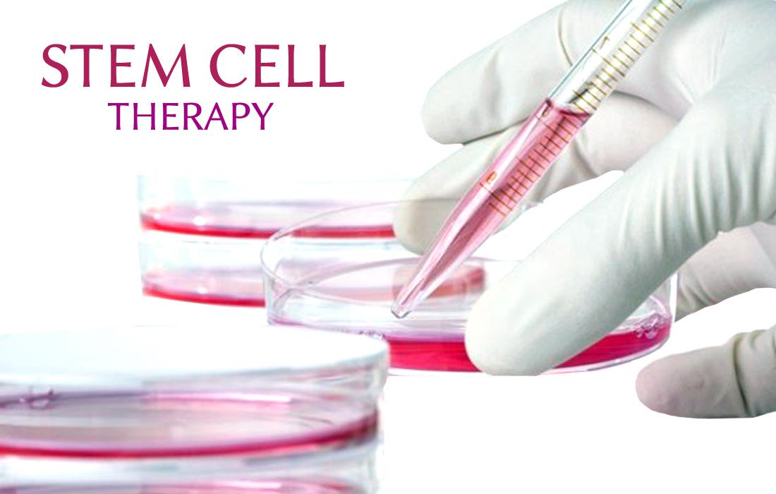 What Is A Miami Stem Cell Therapy?
