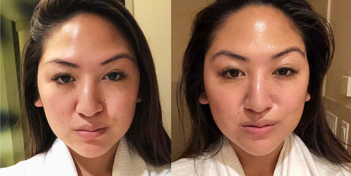 Work Your Face Out With a Microcurrent Facial