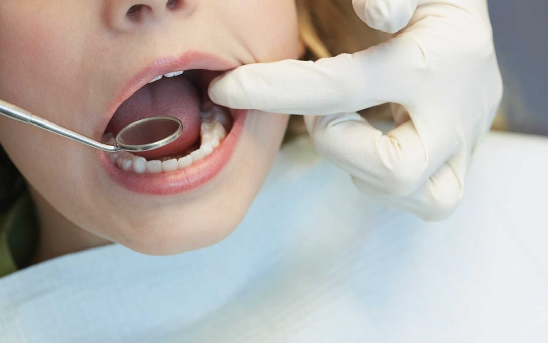 Most Common Dental Issues