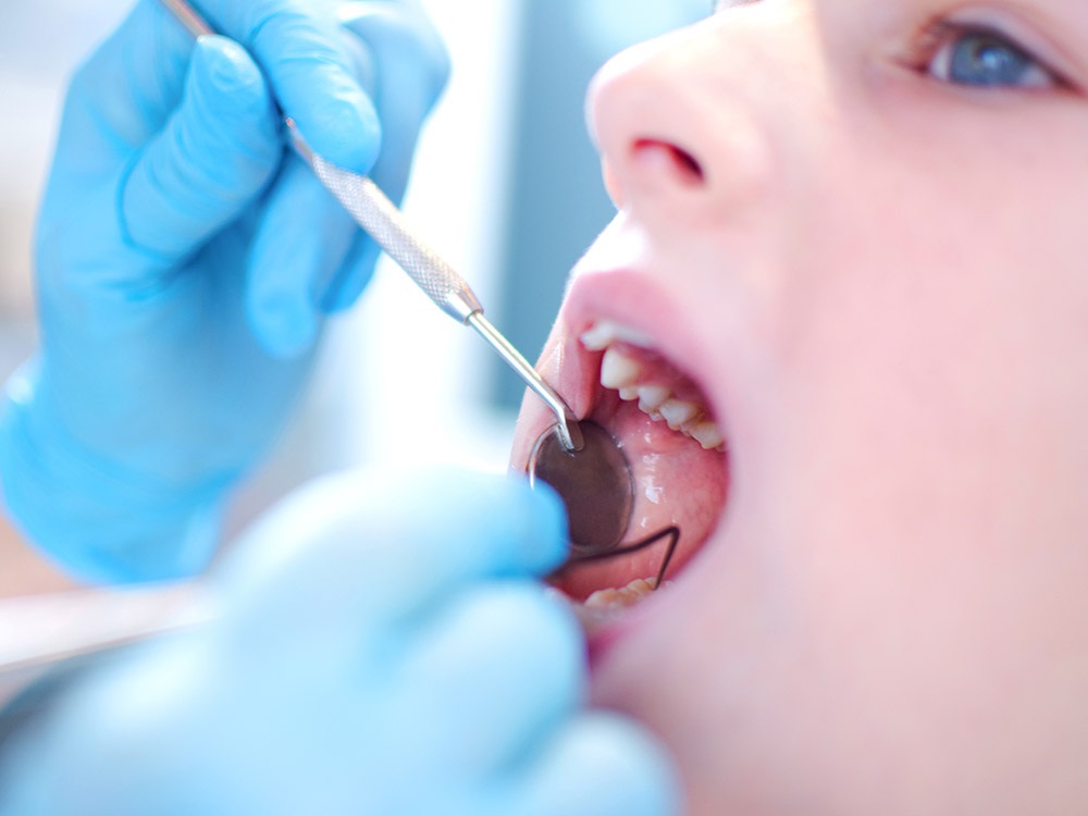 Four Indicators of Bad Oral Health