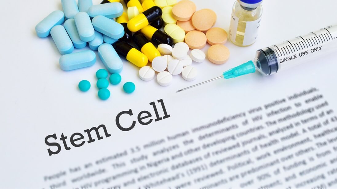 Stem Cell Therapy