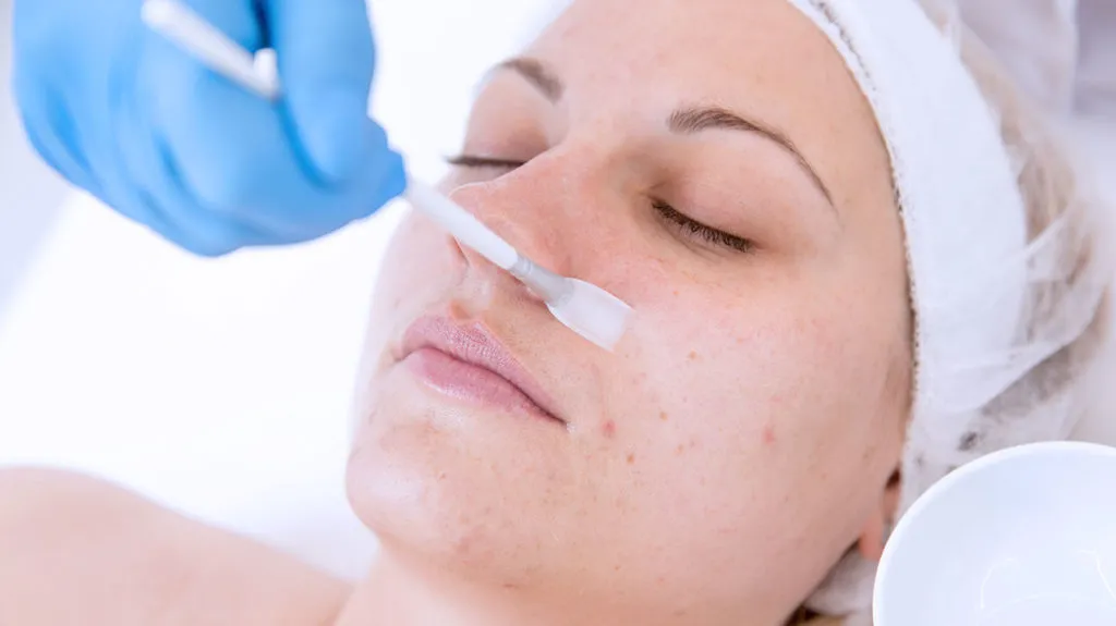 Common Skin Complications That Chemical Peels Treat