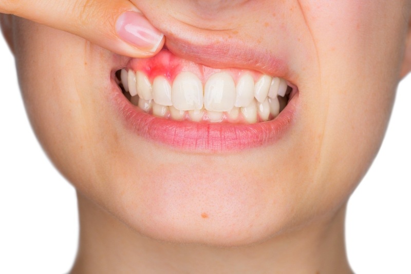 5 Effective Gum Disease & Periodontics Treatment