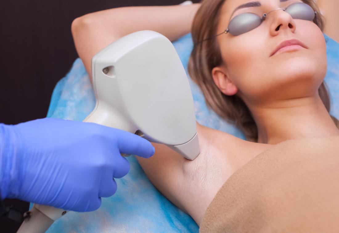 Important Things to Do Before Laser Hair Removal Treatment