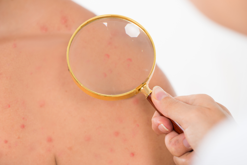 Common Skin Conditions Treated by Dermatologists
