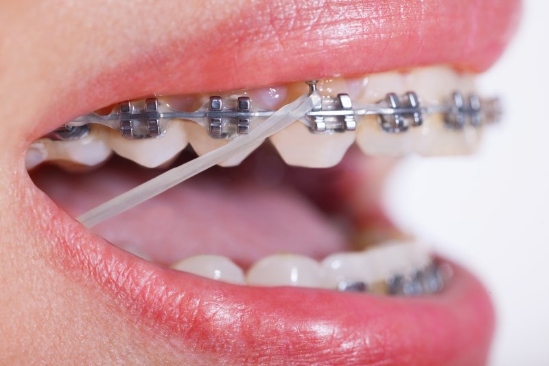 What Is Adult Orthodontic All About?