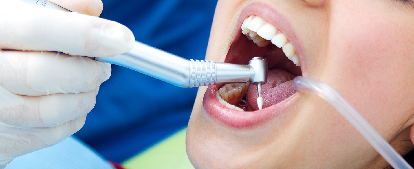 6 Quick and Effective Recovery Tips After Root Canal Treatment 