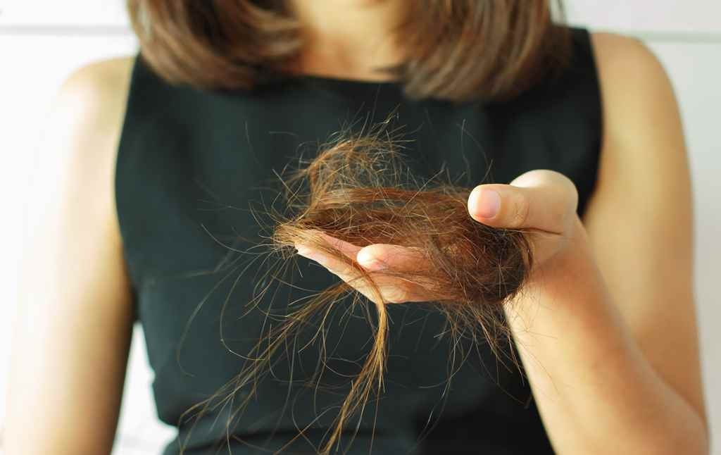 Hair loss: Causes and Remedies
