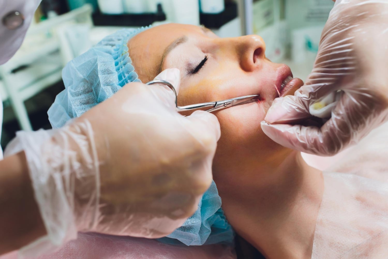 Unlocking the Potential of Facial Neuromuscular Rehabilitation in San Diego, California
