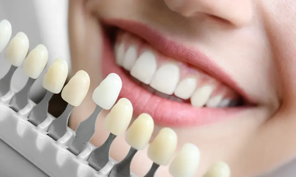 Can Porcelain Veneers Fix Gaps Between Teeth?