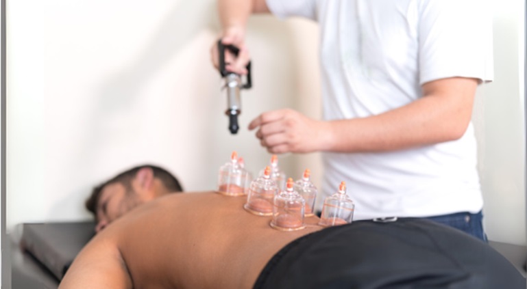 Cupping for Skin Health: Can It Improve Acne, Scars, and Wrinkles?
